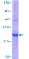 EGLN3 / PHD3 Protein - 12.5% SDS-PAGE Stained with Coomassie Blue.