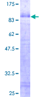 EGR2 Protein - 12.5% SDS-PAGE of human EGR2 stained with Coomassie Blue