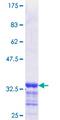 EGR2 Protein - 12.5% SDS-PAGE Stained with Coomassie Blue.