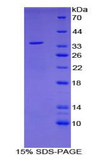 EGR3 Protein - Recombinant Early Growth Response Protein 3 By SDS-PAGE