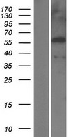 EGR4 / EGR-4 Protein - Western validation with an anti-DDK antibody * L: Control HEK293 lysate R: Over-expression lysate