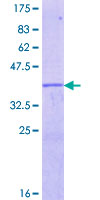 EGR4 / EGR-4 Protein - 12.5% SDS-PAGE Stained with Coomassie Blue.