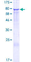 EHD2 Protein - 12.5% SDS-PAGE of human EHD2 stained with Coomassie Blue