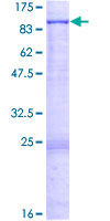 EHHADH / Enoyl-Coa Hydratase Protein - 12.5% SDS-PAGE of human EHHADH stained with Coomassie Blue