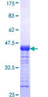 EHMT1 Protein - 12.5% SDS-PAGE Stained with Coomassie Blue.