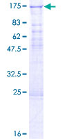 EHMT1 Protein - 12.5% SDS-PAGE of human EHMT1 stained with Coomassie Blue
