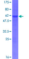 EID1 / EID-1 Protein - 12.5% SDS-PAGE of human CRI1 stained with Coomassie Blue