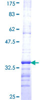 EID1 / EID-1 Protein - 12.5% SDS-PAGE Stained with Coomassie Blue.