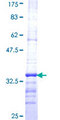 EID1 / EID-1 Protein - 12.5% SDS-PAGE Stained with Coomassie Blue.