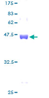 EIF1AX Protein - 12.5% SDS-PAGE of human EIF1AX stained with Coomassie Blue