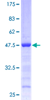 EIF1AY Protein - 12.5% SDS-PAGE of human EIF1AY stained with Coomassie Blue