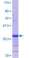 EIF1AY Protein - 12.5% SDS-PAGE Stained with Coomassie Blue.