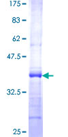 EIF1AY Protein - 12.5% SDS-PAGE Stained with Coomassie Blue.