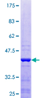 EIF1B Protein - 12.5% SDS-PAGE of human GC20 stained with Coomassie Blue