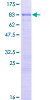 EIF2A / EIF2 Alpha Protein - 12.5% SDS-PAGE of human EIF2A stained with Coomassie Blue
