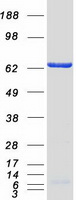 EIF2A / EIF2 Alpha Protein - Purified recombinant protein EIF2A was analyzed by SDS-PAGE gel and Coomassie Blue Staining