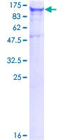 EIF2AK1 Protein - 12.5% SDS-PAGE of human EIF2AK1 stained with Coomassie Blue