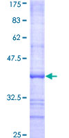 EIF2AK1 Protein - 12.5% SDS-PAGE Stained with Coomassie Blue.