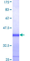 EIF2AK2 / PKR Protein - 12.5% SDS-PAGE Stained with Coomassie Blue