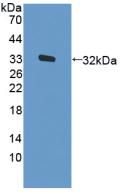 EIF2AK2 / PKR Protein - Active Protein Kinase R (PKR) by WB