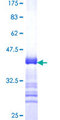 EIF2AK3 / PERK Protein - 12.5% SDS-PAGE Stained with Coomassie Blue.