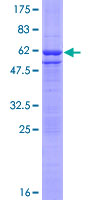 EIF2B1 Protein - 12.5% SDS-PAGE of human EIF2B1 stained with Coomassie Blue
