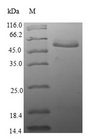 EIF2B1 Protein - (Tris-Glycine gel) Discontinuous SDS-PAGE (reduced) with 5% enrichment gel and 15% separation gel.