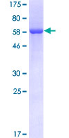 EIF2B2 Protein - 12.5% SDS-PAGE of human EIF2B2 stained with Coomassie Blue