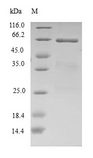 EIF2B2 Protein - (Tris-Glycine gel) Discontinuous SDS-PAGE (reduced) with 5% enrichment gel and 15% separation gel.