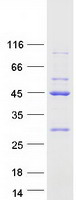 EIF2B2 Protein - Purified recombinant protein EIF2B2 was analyzed by SDS-PAGE gel and Coomassie Blue Staining