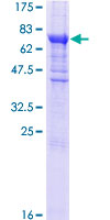 EIF2B3 Protein - 12.5% SDS-PAGE of human EIF2B3 stained with Coomassie Blue