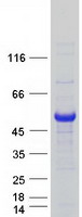 EIF2B3 Protein - Purified recombinant protein EIF2B3 was analyzed by SDS-PAGE gel and Coomassie Blue Staining