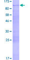 EIF2B5 Protein - 12.5% SDS-PAGE of human EIF2B5 stained with Coomassie Blue