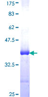 EIF2B5 Protein - 12.5% SDS-PAGE Stained with Coomassie Blue.