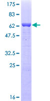 EIF2S1 Protein - 12.5% SDS-PAGE of human EIF2S1 stained with Coomassie Blue