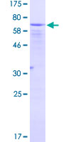 EIF2S2 Protein - 12.5% SDS-PAGE of human EIF2S2 stained with Coomassie Blue