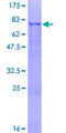 EIF2S3 / EIF2G Protein - 12.5% SDS-PAGE of human EIF2S3 stained with Coomassie Blue