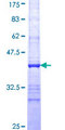 EIF2S3 / EIF2G Protein - 12.5% SDS-PAGE Stained with Coomassie Blue.