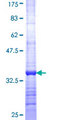 EIF3A Protein - 12.5% SDS-PAGE Stained with Coomassie Blue.