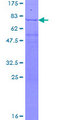 EIF3E Protein - 12.5% SDS-PAGE of human EIF3S6 stained with Coomassie Blue