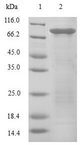 EIF3E Protein - (Tris-Glycine gel) Discontinuous SDS-PAGE (reduced) with 5% enrichment gel and 15% separation gel.