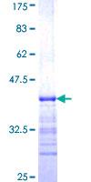 EIF3E Protein - 12.5% SDS-PAGE Stained with Coomassie Blue.