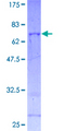 EIF3G Protein - 12.5% SDS-PAGE of human EIF3S4 stained with Coomassie Blue