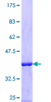 EIF3G Protein - 12.5% SDS-PAGE Stained with Coomassie Blue.