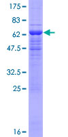 EIF3I / EIF3S2 Protein - 12.5% SDS-PAGE of human EIF3S2 stained with Coomassie Blue
