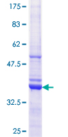 EIF3I / EIF3S2 Protein - 12.5% SDS-PAGE Stained with Coomassie Blue.