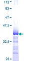 EIF3J Protein - 12.5% SDS-PAGE Stained with Coomassie Blue.