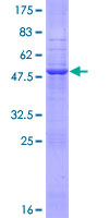 EIF3K Protein - 12.5% SDS-PAGE of human EIF3S12 stained with Coomassie Blue
