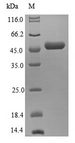 EIF3K Protein - (Tris-Glycine gel) Discontinuous SDS-PAGE (reduced) with 5% enrichment gel and 15% separation gel.