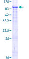 EIF3L / EIF3EIP Protein - 12.5% SDS-PAGE of human EIF3EIP stained with Coomassie Blue